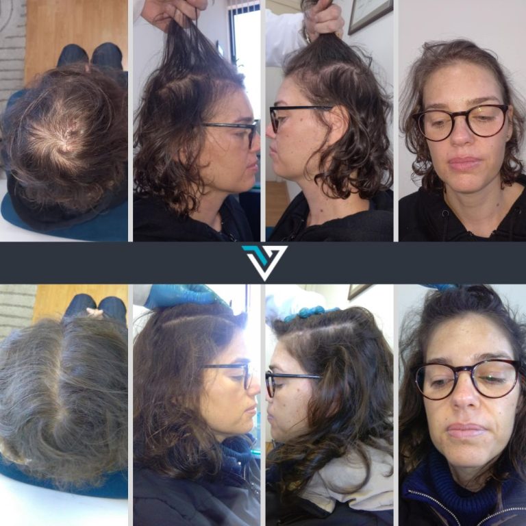 tratamento capilar mulher