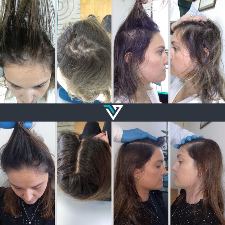 tratamento capilar mulher