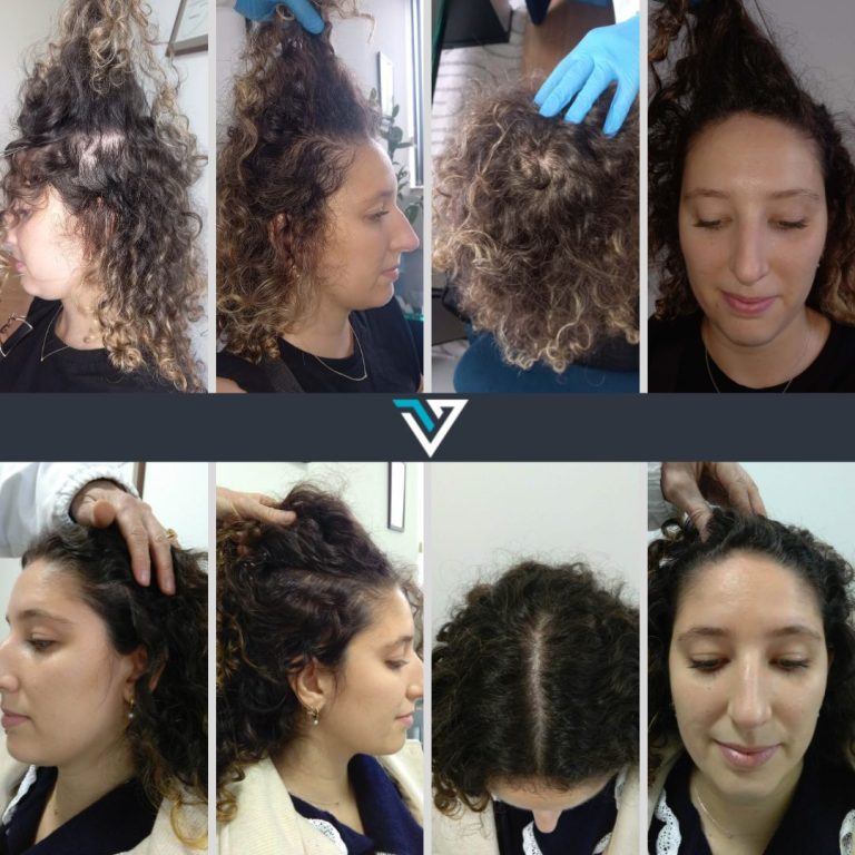 tratamento capilar avançado
