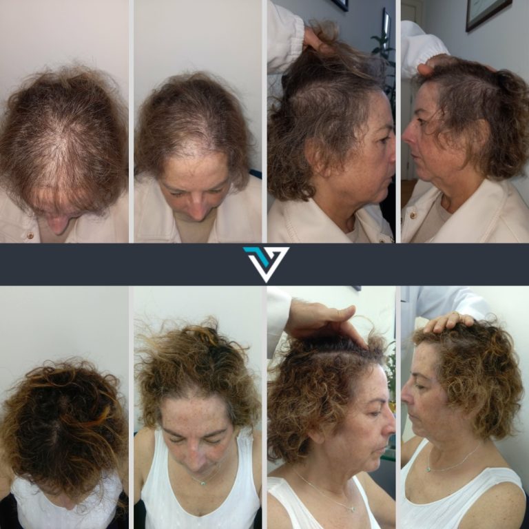 tratamento capilar mulher
